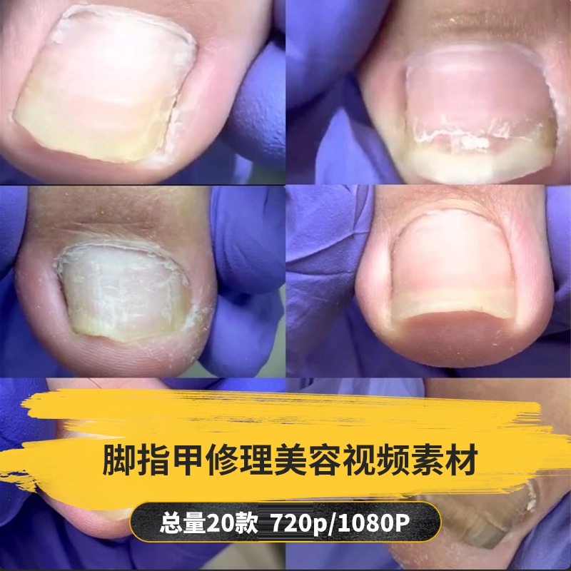 【20款】脚指甲修理美容解压视频素材-捷亚素材网